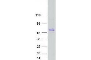 Validation with Western Blot