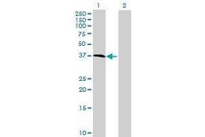 Lane 1: C18orf22 transfected lysate ( 37.