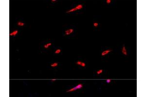 Immunofluorescence analysis of PC-12 cells using EIF3J Polyclonal Antibody at dilution of 1:100. (EIF3S1 抗体)