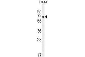 AMY2B Antibody (N-term) western blot analysis in CEM cell line lysates (35µg/lane). (AMY2B 抗体  (N-Term))