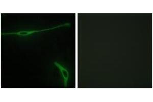 Immunofluorescence analysis of NIH-3T3 cells, using LAMA2 Antibody. (Laminin 抗体  (AA 2011-2060))