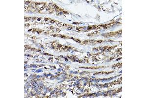 Immunohistochemistry (IHC) image for anti-Egl-9 Family Hypoxia Inducible Factor 3 (EGLN3) (AA 1-120) antibody (ABIN6139990)