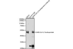 Immunoprecipitation analysis of 300 μg extracts of 293T cells using 3 μg SARS-CoV-2 Nucleoprotein antibody (ABIN7269053). (SARS-CoV-2 Envelope 抗体)