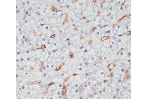 Immunohistochemistry of paraffin-embedded Human liver using CD36 Polyclonal Antibody at dilution of 1:200 (40x lens). (CD36 抗体)