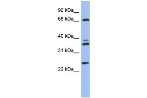 WB Suggested Anti-ATP6V1A Antibody Titration: 0. (ATP6V1A 抗体  (N-Term))