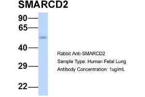 Host:  Rabbit  Target Name:  SMARCD2  Sample Type:  Human Fetal Lung  Antibody Dilution:  1. (SMARCD2 抗体  (Middle Region))
