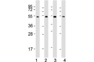 Western blot testing of human 1) Raji, 2) K562, 3) Jurkat and 4) HeLa cell lysate with HSP60 antibody. (HSPD1 抗体  (AA 80-109))