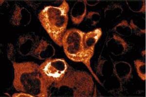 Immunofluorescence staining of A431 cells. (Kalinin B1 (AA 1009-1170) 抗体)