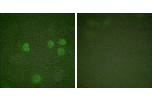 Forskolin + -Immunofluorescence analysis of HeLa cells, treated with Forskolin (40nM, 30mins), using Cyclin B1 (Ab-126) antibody (#BOO68). (Cyclin B1 抗体  (Ser126))