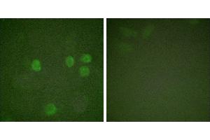 Forskolin + -Immunofluorescence analysis of HeLa cells, treated with Forskolin (40nM, 30mins), using Cyclin B1 (Ab-126) antibody (#BOO68).