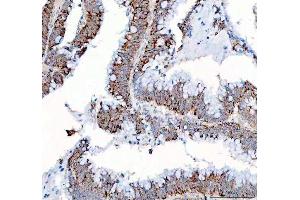 IHC analysis of PPA2 using anti-PPA2 antibody (ABIN6719431). (PPA2 抗体  (AA 33-334))