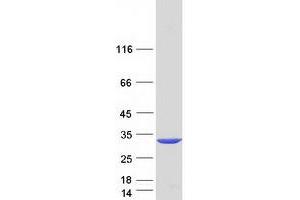 Western Blotting (WB) image for Coiled-Coil Domain Containing 46 (CCDC46) (Transcript Variant 2) protein (Myc-DYKDDDDK Tag) (ABIN2713301)