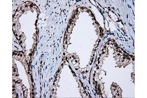 Immunohistochemical staining of paraffin-embedded Kidney tissue using anti-APP mouse monoclonal antibody. (APP 抗体)