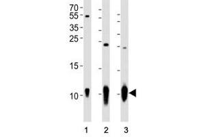 Western Blotting (WB) image for anti-S100 Calcium Binding Protein B (S100B) antibody (ABIN3032516)