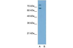 Host:  Rabbit  Target Name:  RORA  Sample Type:  Jurkat  Lane A:  Primary Antibody  Lane B:  Primary Antibody + Blocking Peptide  Primary Antibody Concentration:  2. (RORA 抗体  (Middle Region))