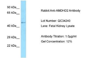 Host: Rabbit Target Name: AMDHD2 Sample Type: Fetal Kidney Antibody Dilution: 1. (AMDHD2 抗体  (N-Term))