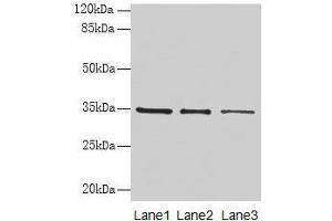 Western blot All lanes: GDF15 antibody at 4 μg/mL Lane 1: HepG2 whole cell lysate Lane 2: Human placenta tissue Lane 3: A549 whole cell lysate Secondary Goat polyclonal to rabbit IgG at 1/10000 dilution Predicted band size: 35 kDa Observed band size: 35 kDa (GDF15 抗体  (AA 198-308))