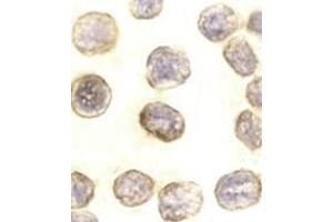 Immunocytochemistry of DAXX in HeLa cells with AP30275PU-N DAXX antibody at 10 μg/ml. (DAXX 抗体  (C-Term))