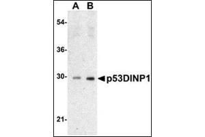 Western blot analysis of TP53INP1 expression in Human lung tissue lysate with AP30639PU-N TP53INP1 antibody at 0. (TP53INP1 抗体  (N-Term))