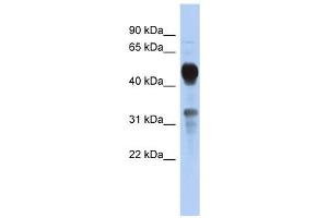 MVK antibody used at 1 ug/ml to detect target protein. (MVK 抗体  (Middle Region))