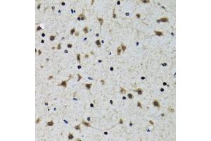 Immunohistochemistry of paraffin-embedded rat brain using SLC23A2 antibody (ABIN2559957) at dilution of 1:100 (40x lens). (SLC23A2 抗体)