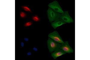 ABIN7094643 and ABIN7098693 staining  cells by IF/ICC. (SALL1 抗体  (N-Term))
