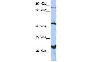 MRS2L antibody used at 1 ug/ml to detect target protein. (MRS2 抗体  (Middle Region))