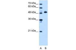 Western Blotting (WB) image for anti-ATP Synthase, H+ Transporting, Mitochondrial F1 Complex, beta Polypeptide (ATP5B) (N-Term) antibody (ABIN629672)