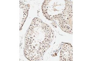 Immunohistochemical analysis of paraffin-embedded human testis tissue using (ABIN388841 and ABIN2839148) performed on the Leica® BOND RXm. (UBE4B 抗体  (N-Term))