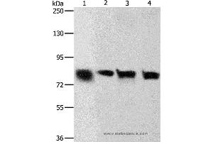 Western blot analysis of Hela and A549 cell, human liver cancer tissue and HT-29 cell, using CDH6 Polyclonal Antibody at dilution of 1:500 (CDH6 抗体)