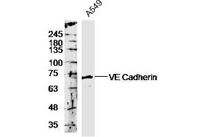 A549 lyates probed with Rabbit Anti-VE Cadherin Polyclonal Antibody, Unconjugated  at 1:300 in 4˚C overnight.