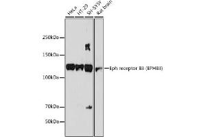 Western blot analysis of extracts of various cell lines, using Eph receptor B3 (EPHB3) (EPHB3) antibody (ABIN7266972) at 1:1000 dilution. (EPH Receptor B3 抗体)