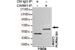 Immunoprecipitation analysis of Hela cell lysates using PRMT4/CARM1 mouse mAb. (CARM1 抗体)