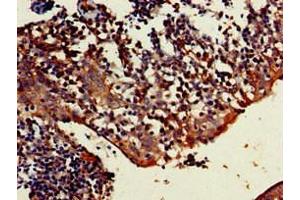 Immunohistochemistry of paraffin-embedded human tonsil tissue using ABIN7173455 at dilution of 1:100 (TRIM5 抗体  (AA 1-493))