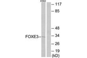 Western blot analysis of extracts from K562 cells, using FOXE3 Antibody. (FOXE3 抗体  (AA 81-130))