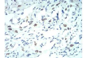 Immunohistochemistry (IHC) image for anti-Karyopherin alpha 2 (RAG Cohort 1, Importin alpha 1) (KPNA2) (AA 1-530) antibody (ABIN5542626)