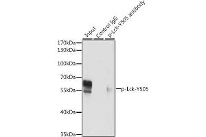 Immunoprecipitation analysis of 200 μg extracts of Jurkat cells, using 3 μg Phospho-Lck-Y505 pAb (ABIN3020027, ABIN3020028, ABIN3020029 and ABIN6225502). (LCK 抗体  (pTyr505))