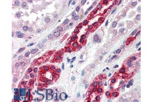 Immunohistochemistry (IHC) image for anti-Golgi-Associated, gamma Adaptin Ear Containing, ARF Binding Protein 3 (GGA3) (C-Term) antibody (ABIN185453)