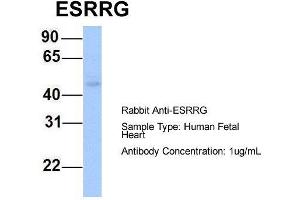 Host: Rabbit Target Name: ESRRG Sample Type: Human Fetal Heart Antibody Dilution: 1. (ESRRG 抗体  (N-Term))