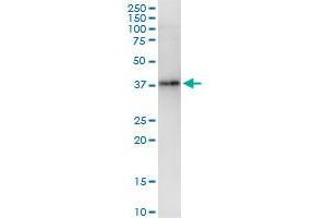 Immunoprecipitation of DBC1 transfected lysate using anti-DBC1 MaxPab rabbit polyclonal antibody and Protein A Magnetic Bead , and immunoblotted with DBC1 purified MaxPab mouse polyclonal antibody (B01P) . (DBC1 抗体  (AA 1-320))