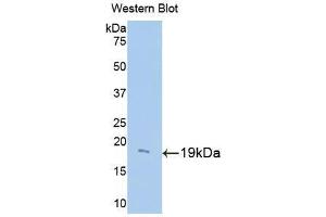 Western blot analysis of the recombinant protein. (UCP2 抗体  (AA 150-304))