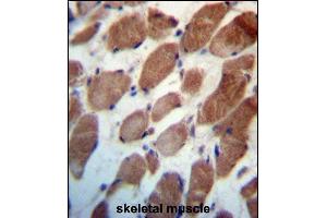 TRIM54 Antibody (N-term) (ABIN657215 and ABIN2846323) immunohistochemistry analysis in formalin fixed and paraffin embedded human skeletal muscle followed by peroxidase conjugation of the secondary antibody and DAB staining. (TRIM54 抗体  (N-Term))