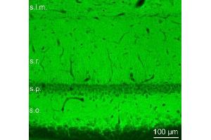 Indirect immunolabeling of PFA fixed rat hippocampus sections. (Piccolo 抗体  (AA 4439-4776))