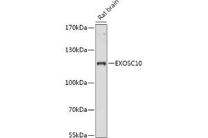 Western blot analysis of extracts of Rat brain, using EXOSC10 antibody (ABIN7267062) at 1:1000 dilution. (EXOSC10 抗体  (AA 586-885))