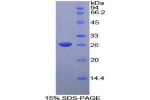 SDS-PAGE analysis of Rat DNASE1L2 Protein.