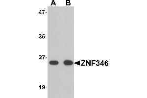 Western blot analysis of TRIP6 in EL4 cell lysate with TRIP6 antibody at 1 µg/mL. (ZNF346 抗体  (N-Term))