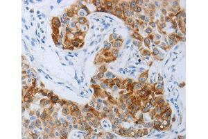 Immunohistochemistry (IHC) image for anti-Pyrimidinergic Receptor P2Y, G-Protein Coupled, 4 (P2RY4) (AA 286-365) antibody (ABIN3017282) (P2RY4 抗体  (AA 286-365))