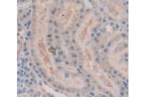 IHC-P analysis of Rat Tissue, with DAB staining. (Androgen Receptor 抗体  (AA 765-902))