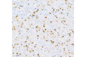 Immunohistochemistry of paraffin embedded rat brain using MAP7 (ABIN7074621) at dilution of 1:600 (300x lens)
