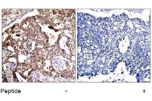 Image no. 1 for anti-Mitogen-Activated Protein Kinase Kinase 4 (MAP2K4) (Ser80) antibody (ABIN197325) (MAP2K4 抗体  (Ser80))